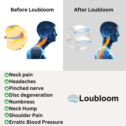 Loubloom™ Neck Stretcher